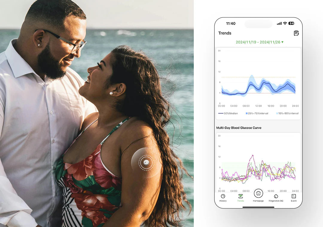 GluX glükóz monitorozó CGM szenzor próba csomag (1db)