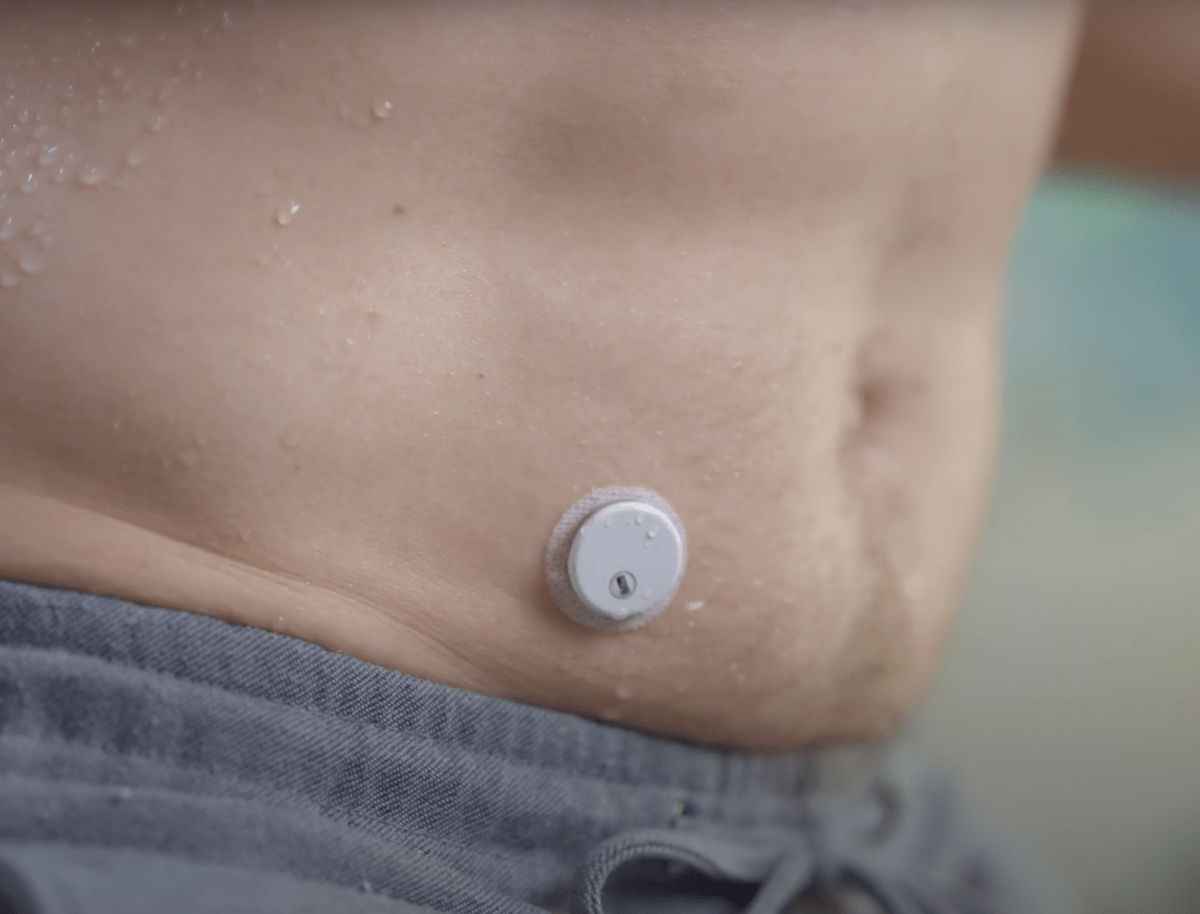 VitaTok CGM - 15 napos AI támogatott folyamatos vércukor monitorozás (CGM) érzékelő